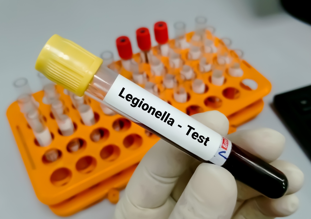 Test legionella